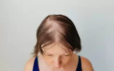 George Brennan - Hair Transplant Surgeon at Neograft Hair Restoration Orange County