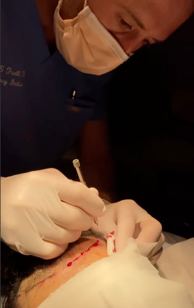 Greg Powell - Hair Transplant Surgeon at Best Hair Transplant